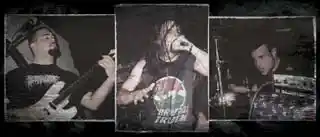 Cerebral Hemmorhage